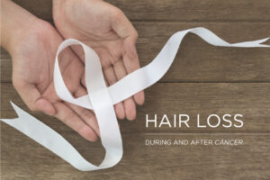 HAAR VERLIEZEN MET KANKER | Extensions Na Chemo | Hairatin