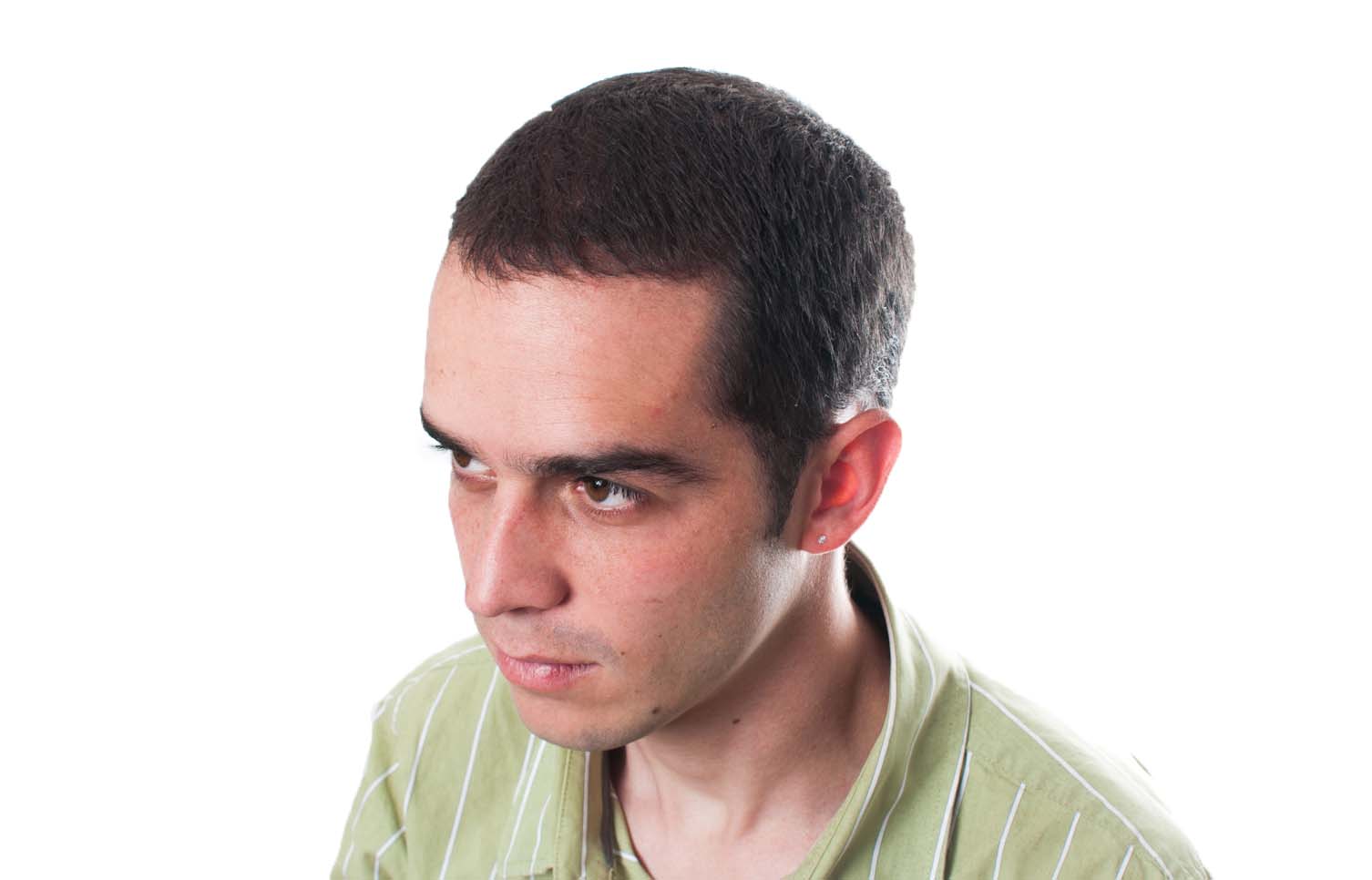 haaruitval haaruitval