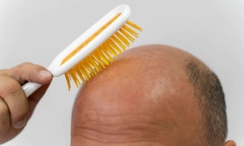 Haarverdunnende Oplossing